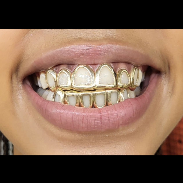 6 Top & 6 Bottom Open Face Grillz grillzpage.com