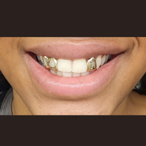 Two Open & Star Cut out Grillz grillzpage.com