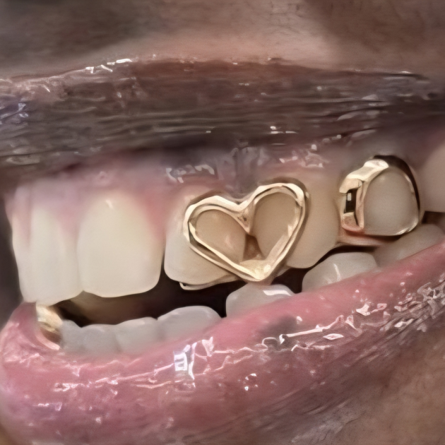 3D Heart Outline with open Grillz- 3 Teeth