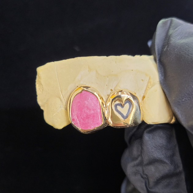 Heart Cutout & Pink Opal Grillz grillzpage.com