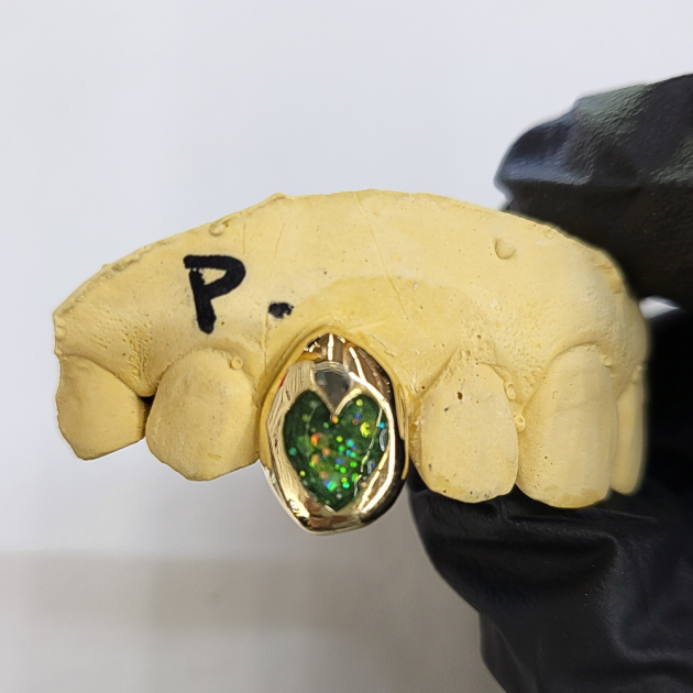 Heart Opal Cap Grillz grillzpage.com