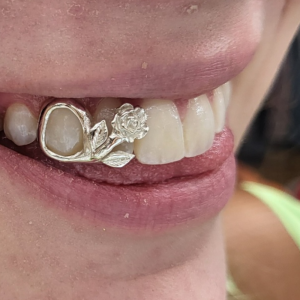 Blossom Rose Grillz grillzpage.com