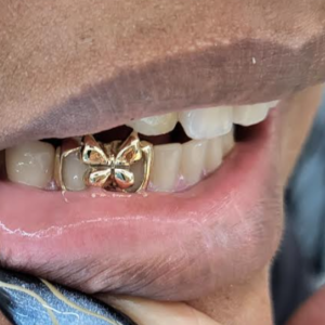 Butterfly Blaze Grillz grillzpage.com