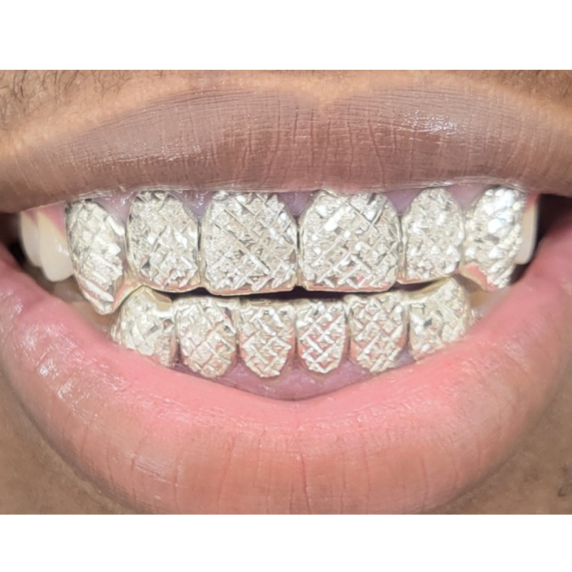 Solid with Diamond Cut Design Grillz grillzpage.com