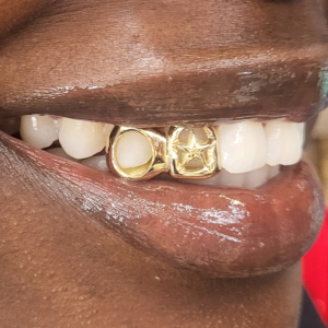Reverse Star Cutout & Open Face Grillz grillzpage.com