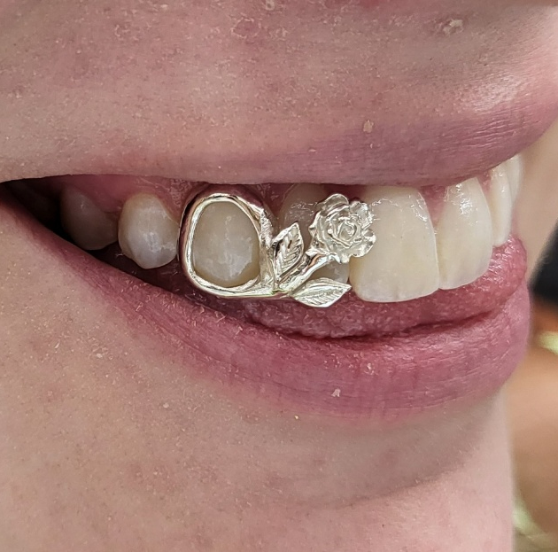 Blossom Rose Grillz grillzpage.com