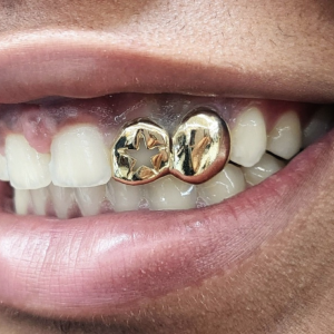 Star Cutout with Solid Grillz grillzpage.com