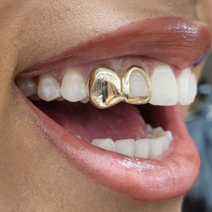 Solid Canine with Open Face Grillz grillzpage.com