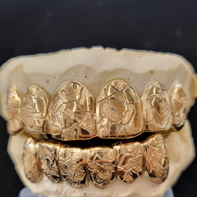 Nugget Cut Solid Face Grillz 6top & 6 Bottom grillzpage.com