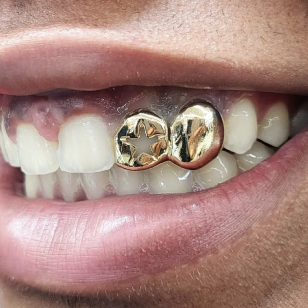 Star Cutout with Solid Grillz grillzpage.com