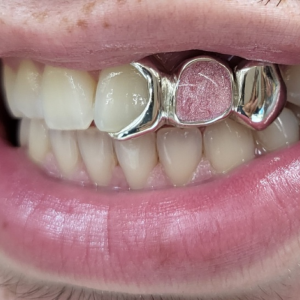 Moon & Opal & Solid Design Grillz grillzpage.com