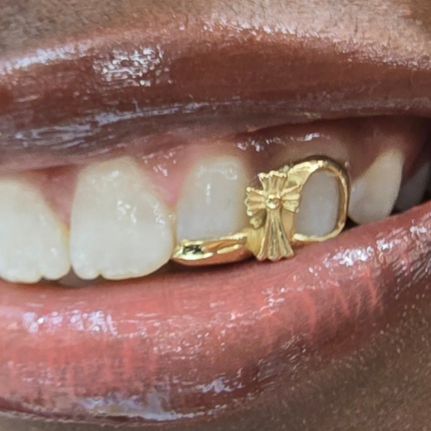 Fancy Cross Bar Window Grillz- 2 Teeth