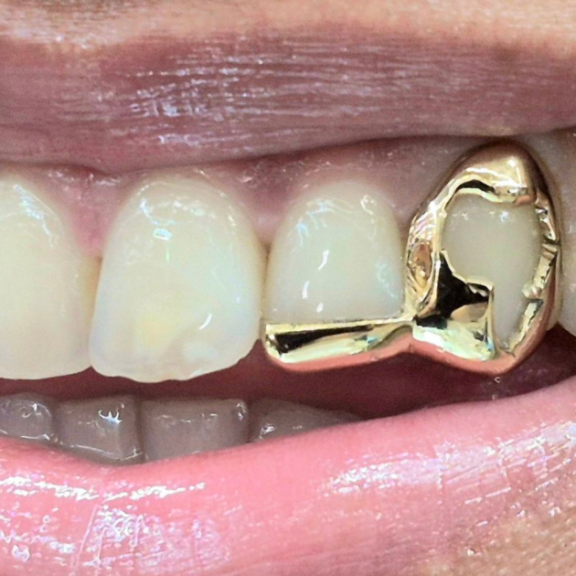 Bar Africa Map Grillz - 2Teeth
