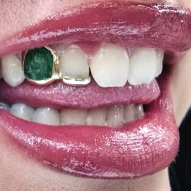 Bar with Green Opal Grillz - 2Teeth